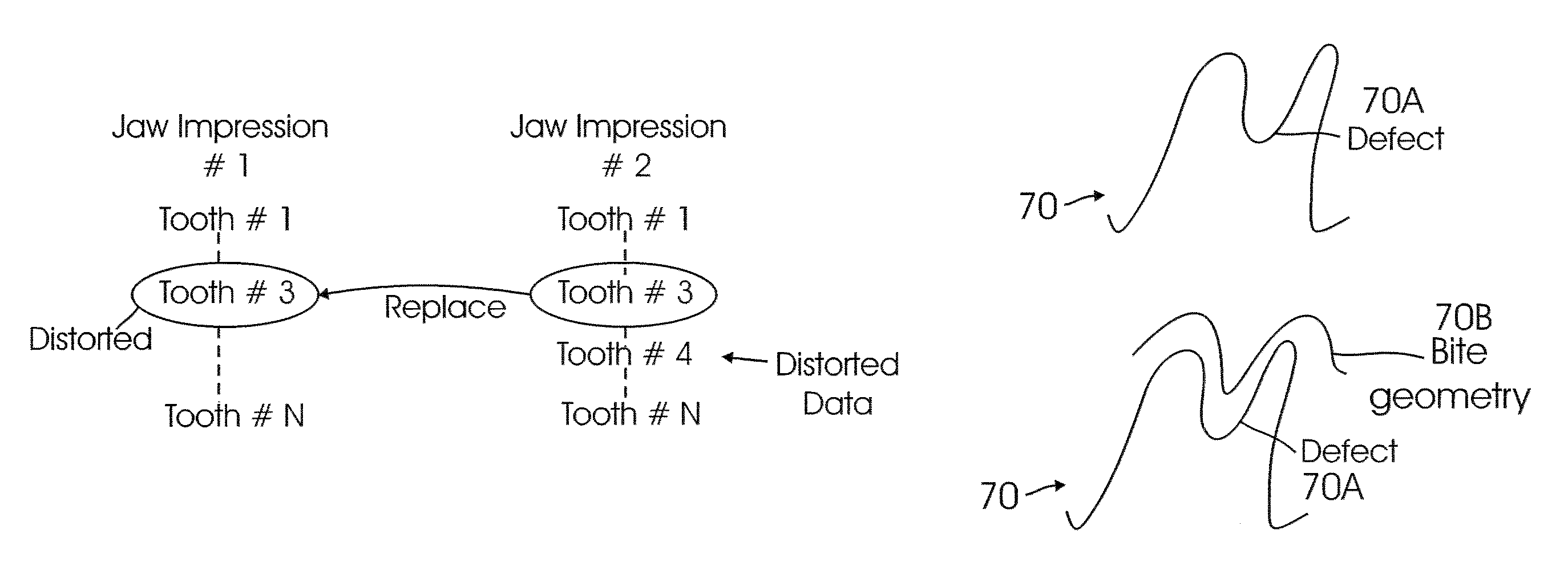 System and method for digital tooth imaging