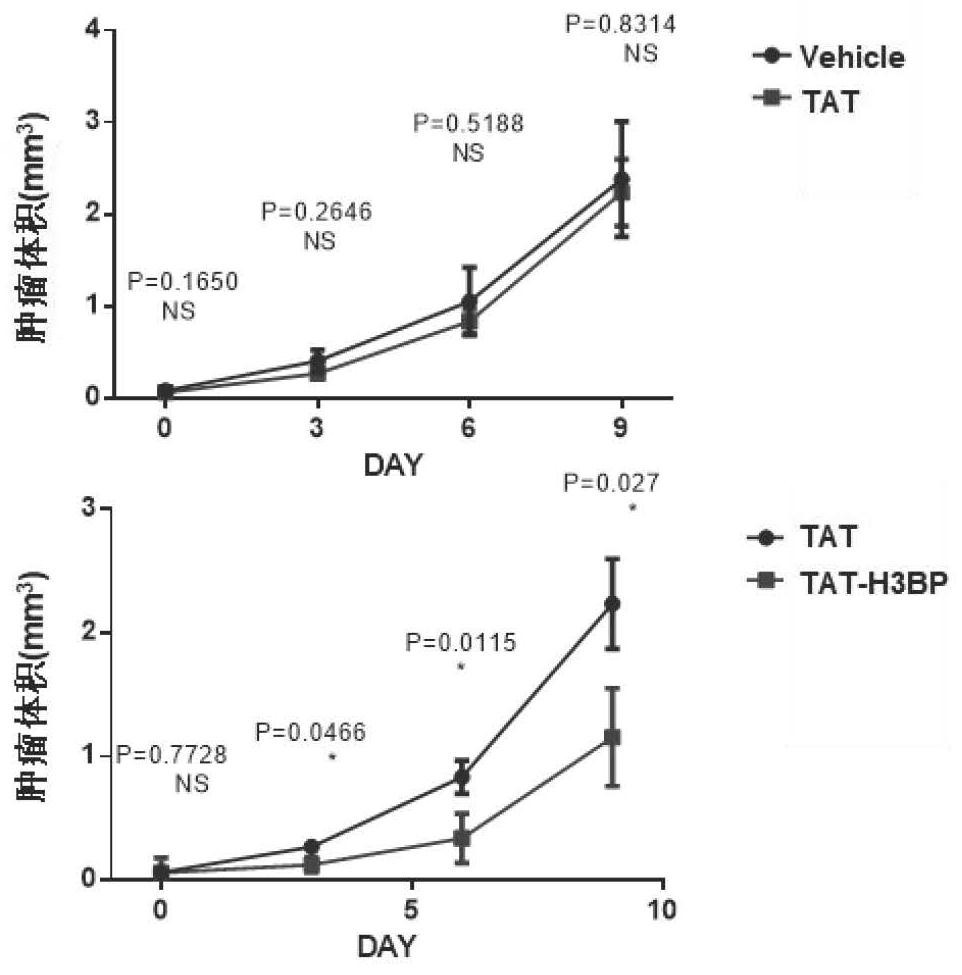 ANP32A-targeted anti-leukemia small molecule peptide as well as preparation method and application thereof