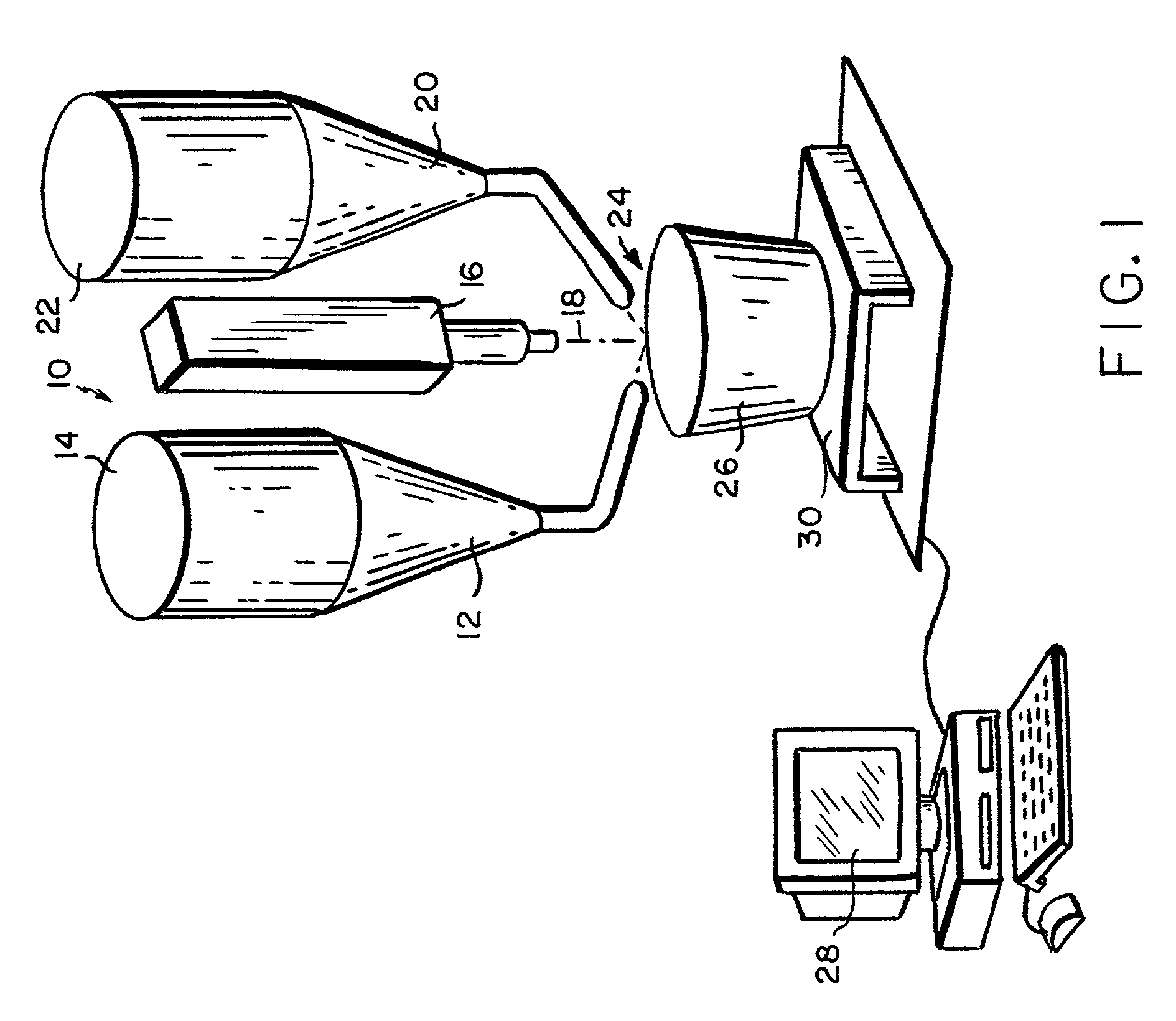 Laser fabrication of discontinuously reinforced metal matrix composites