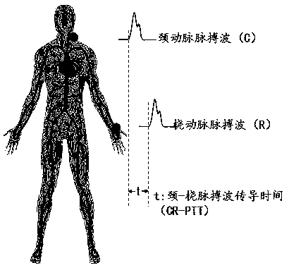 Non-invasive multi-segment peripheral artery blood vessel elastic function detection method and instrument thereof