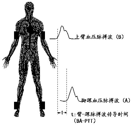 Non-invasive multi-segment peripheral artery blood vessel elastic function detection method and instrument thereof