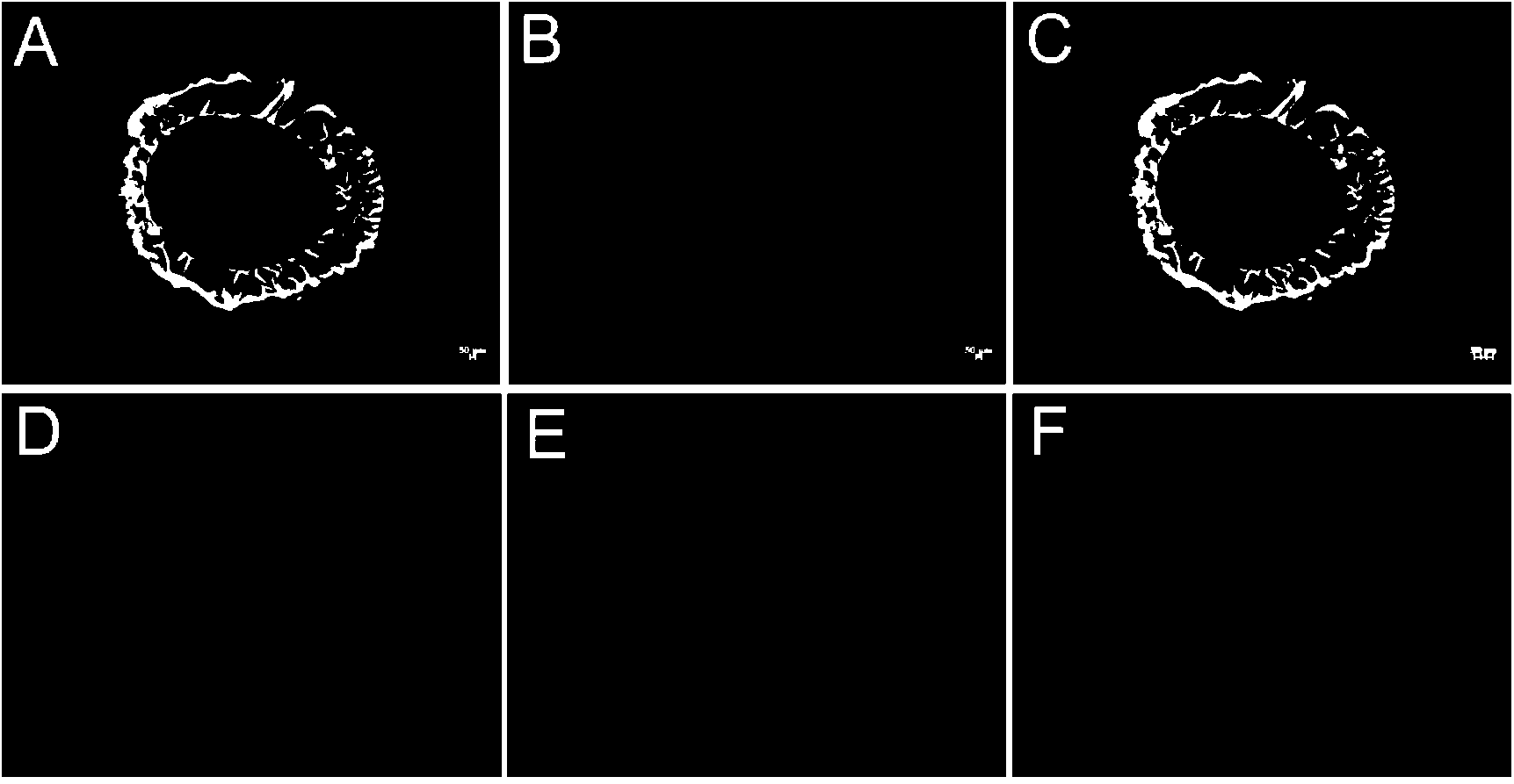 Gene for modifying human acidic fibroblast growth factor applied to silkworm silk gland expression, and expression system and application of gene