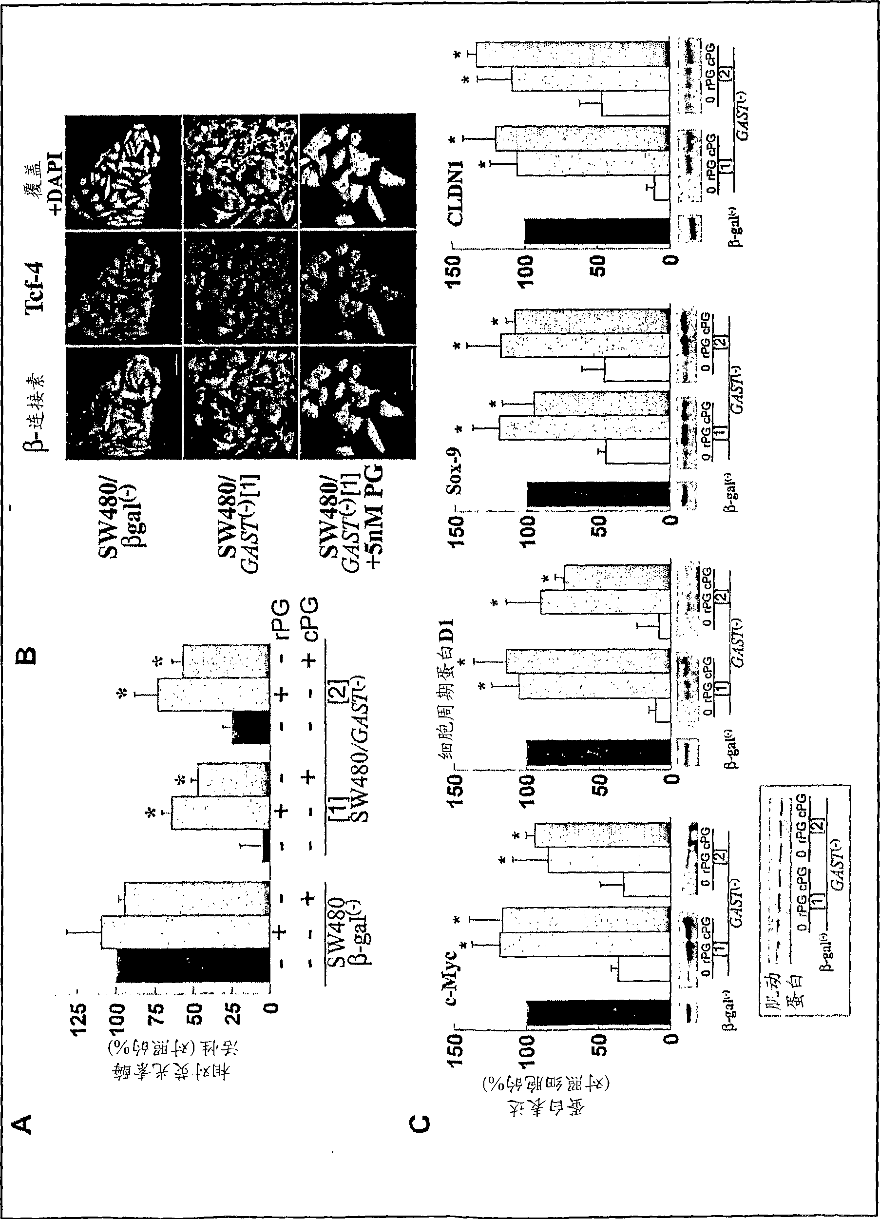 Progastrin inhibitors in the treatment of colon cancer