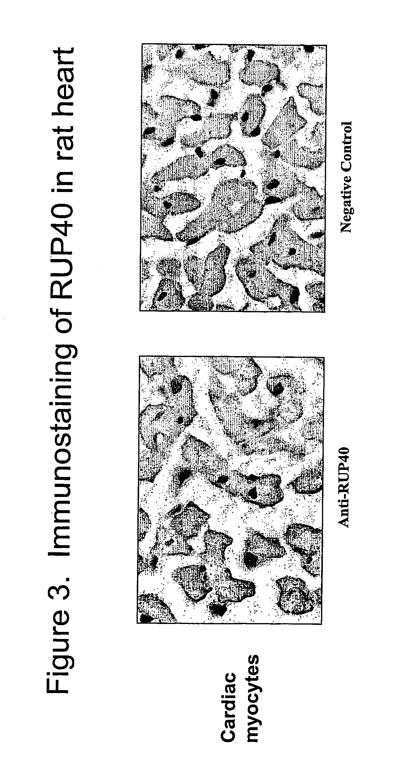 Human G protein-coupled receptor and modulators thereof for the treatment of cardiovascular disorders