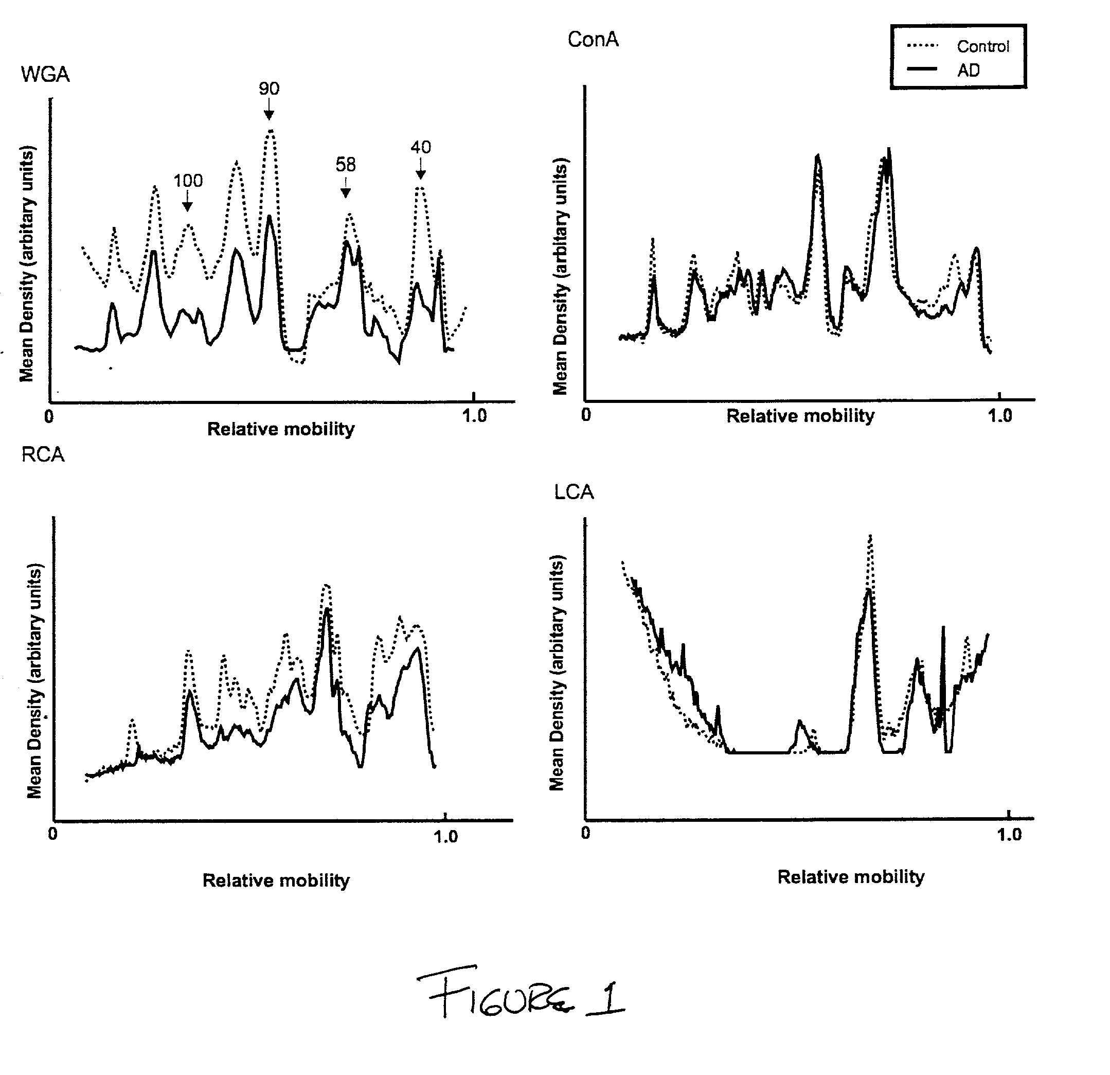 Method for the diagnosis of Alzheimer's Disease and other prion related disorders