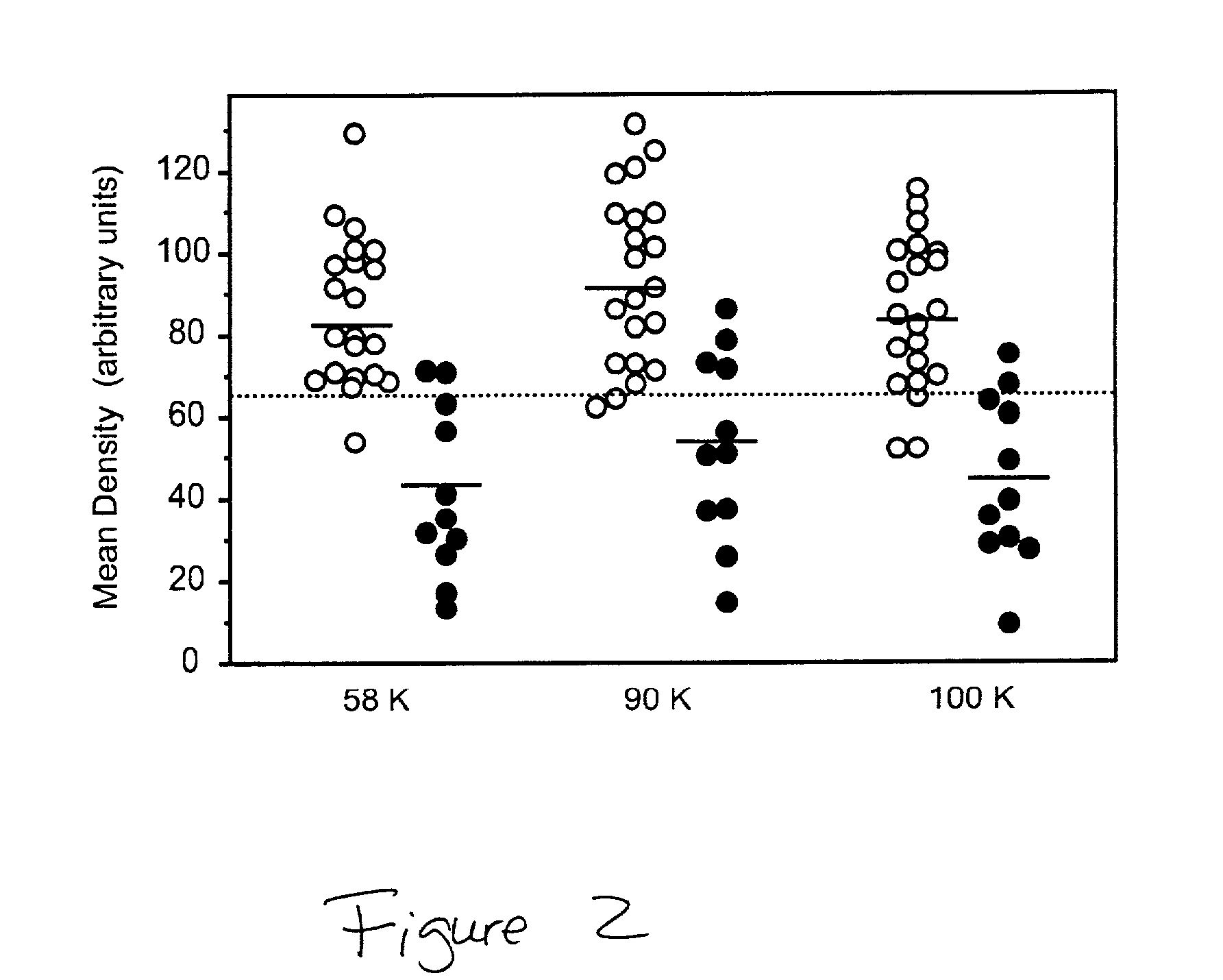 Method for the diagnosis of Alzheimer's Disease and other prion related disorders