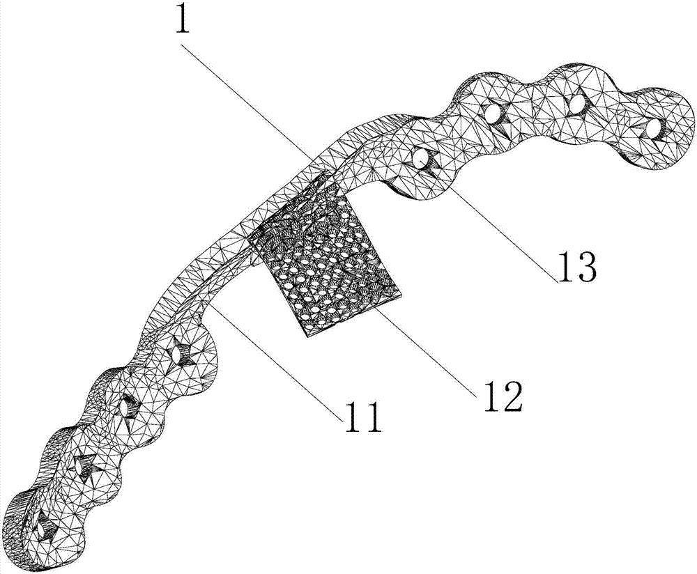 Defective mandibular fracture reconstruction titanium plate with auxiliary bone grafting function