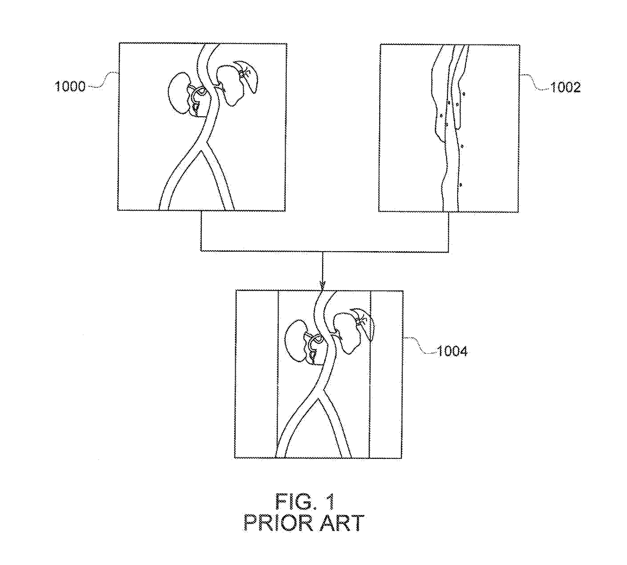 Combination Of 3D Ultrasound And Computed Tomography For Guidance In Interventional Medical Procedures