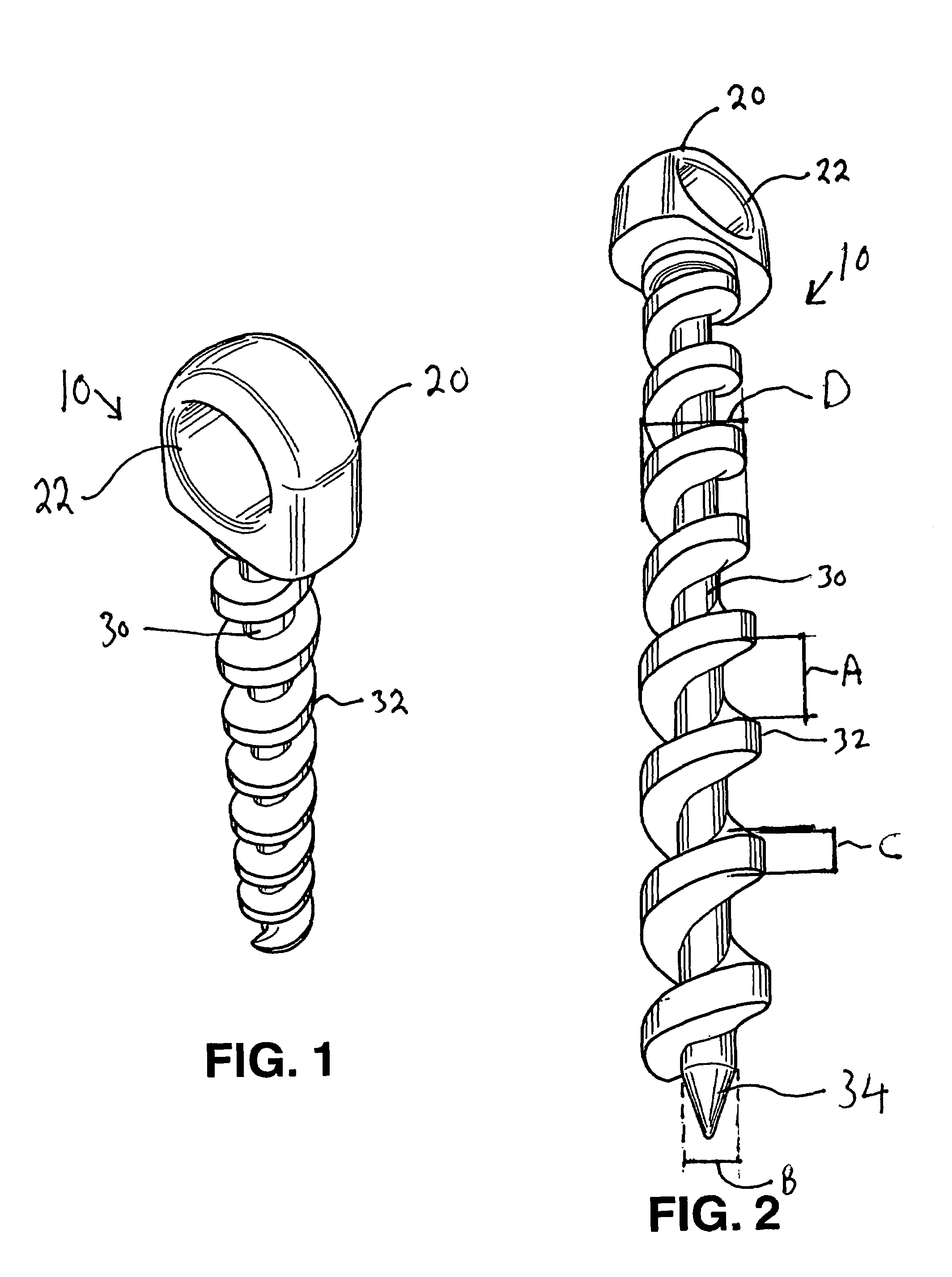 Reusable threaded tie down