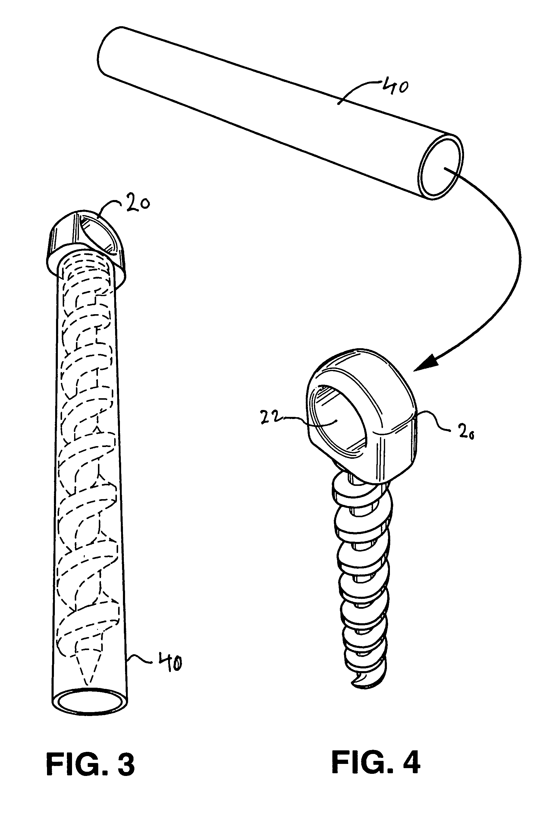 Reusable threaded tie down