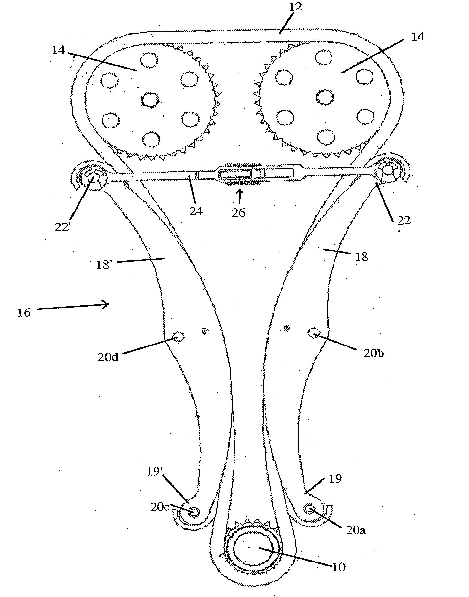 Force limiting tensioning arm