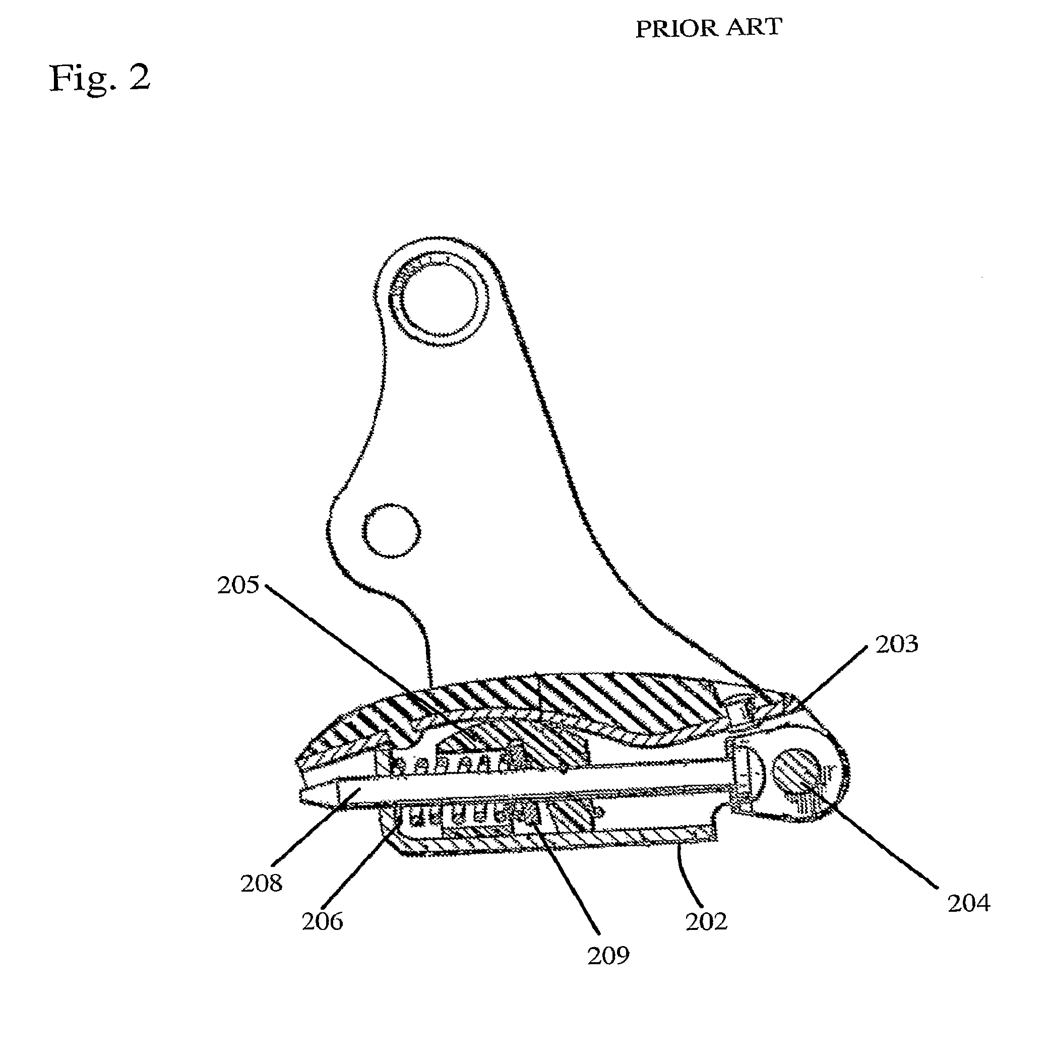 Force limiting tensioning arm