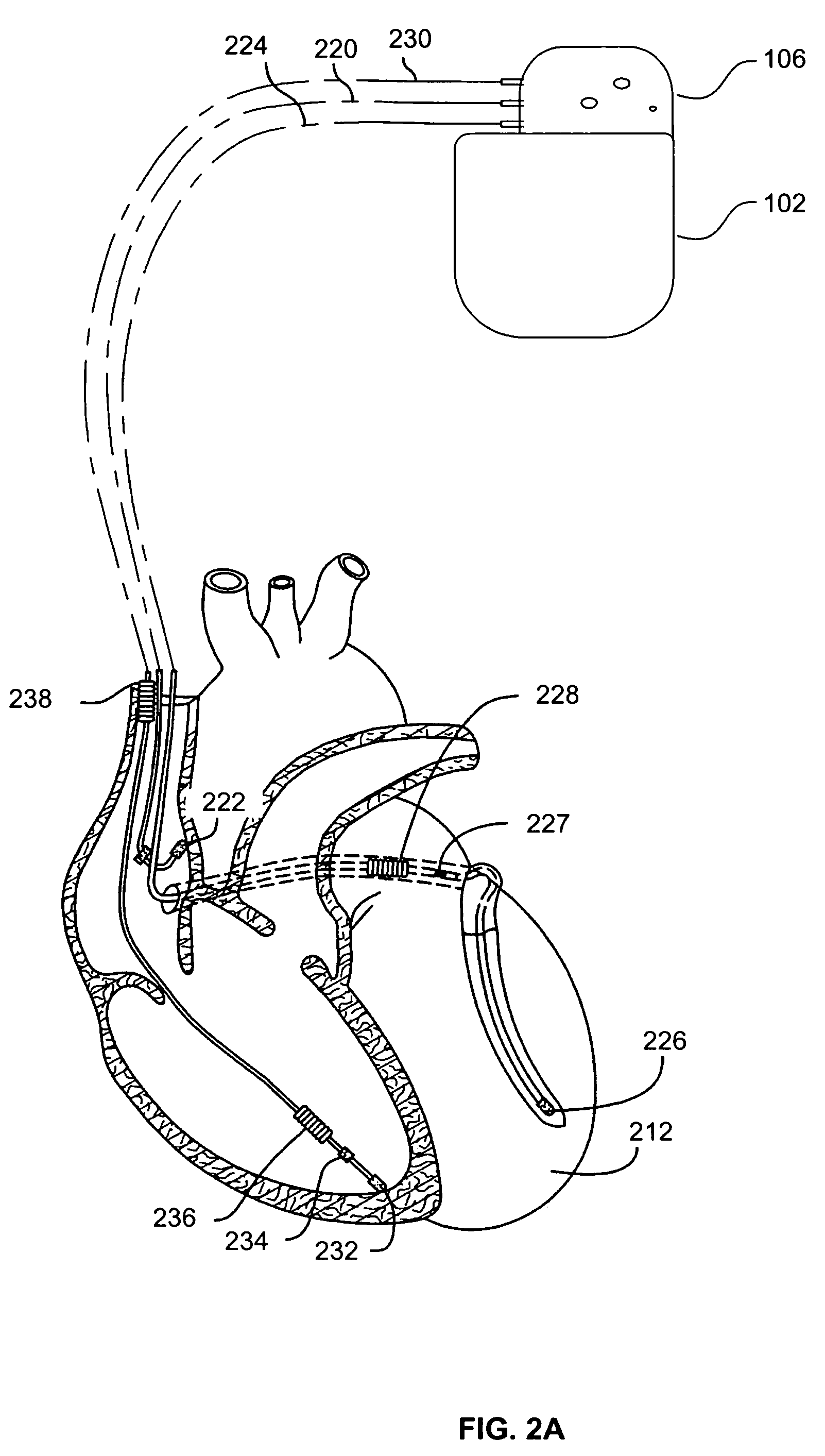 Autonomous sensor modules for patient monitoring