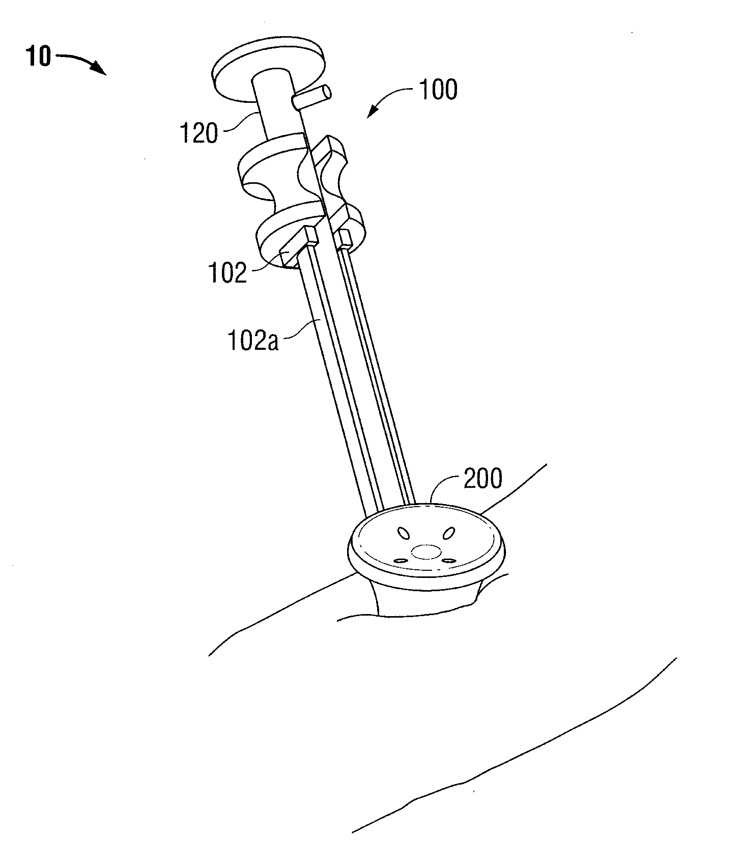 Surgical introducer and access port assembly