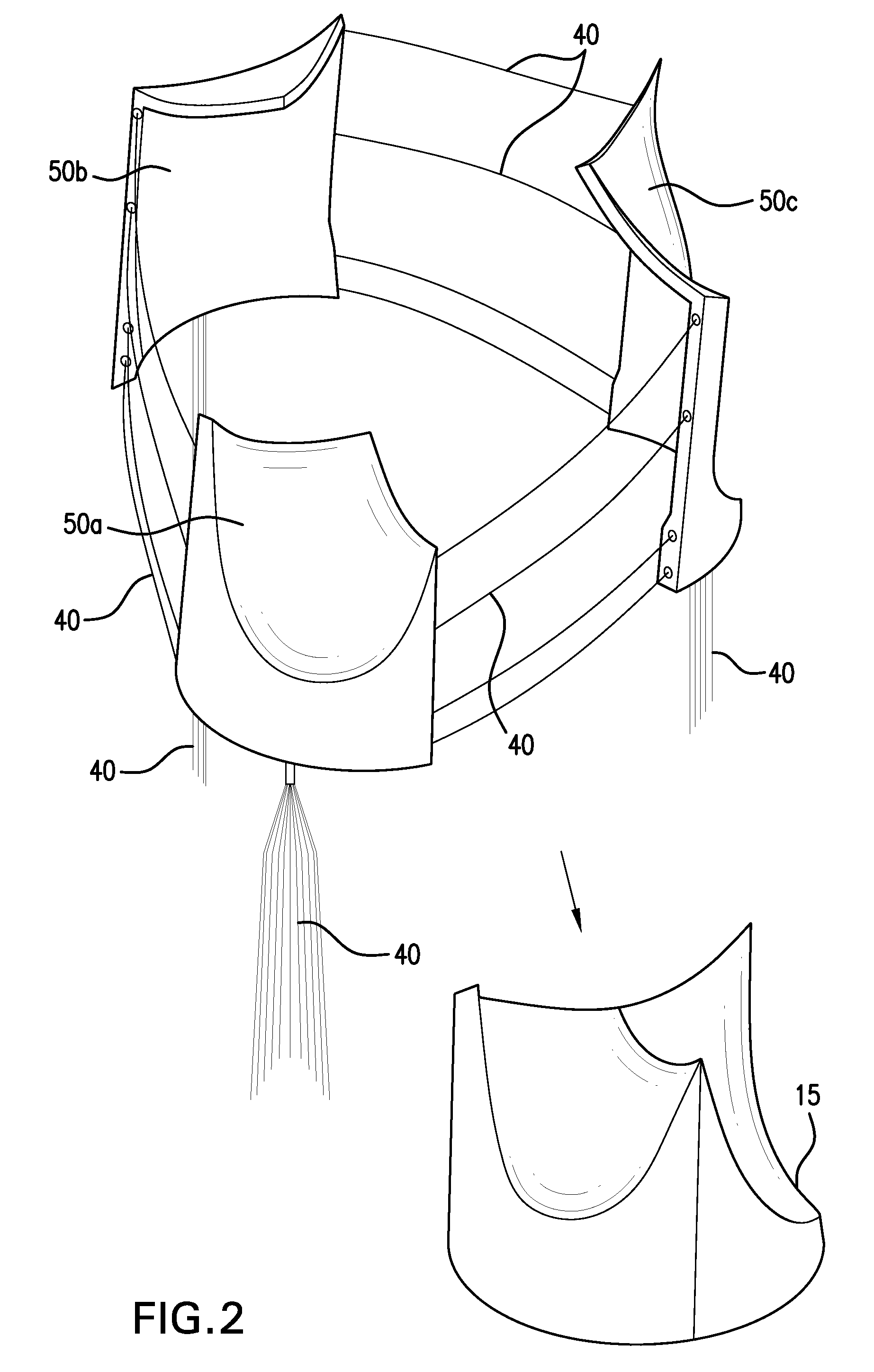 Modular percutaneous valve structure and delivery method