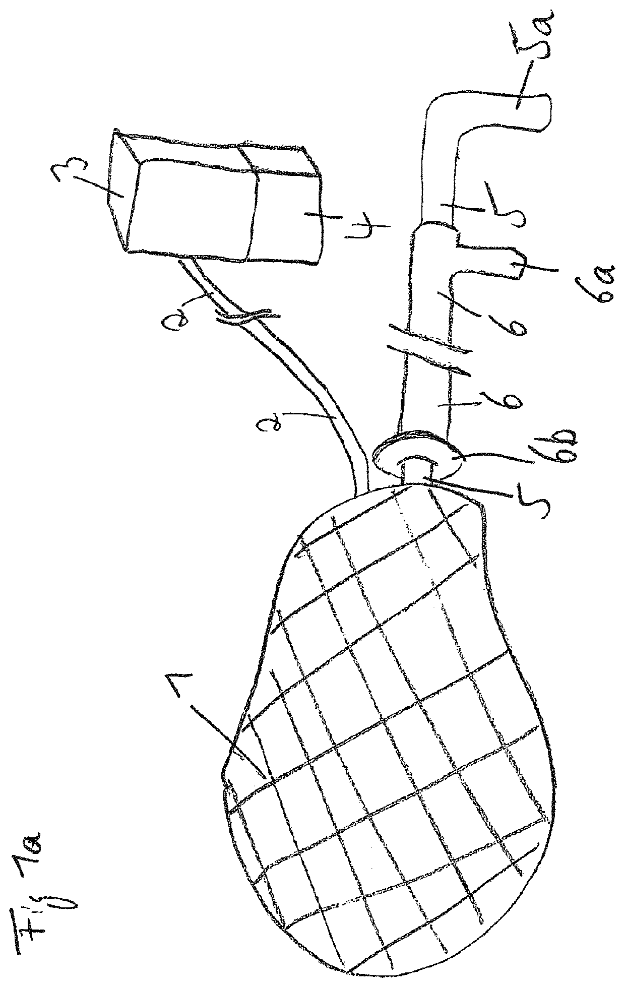 Drainage system and vacuum pump for intrauterine vacuum therapy