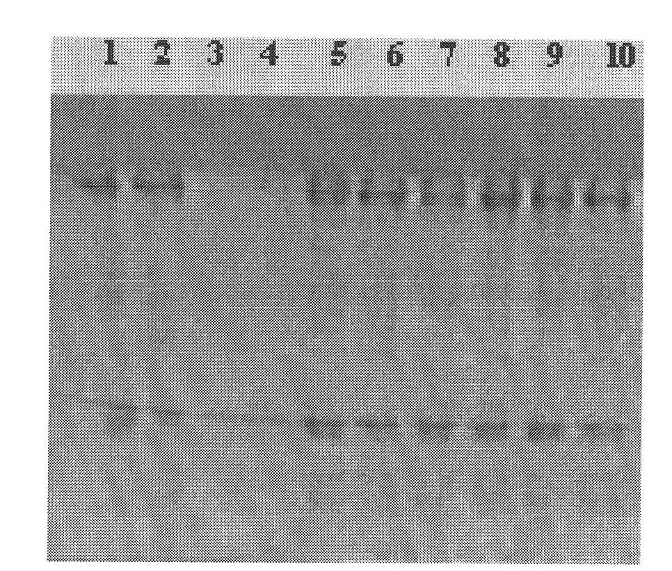 Method for preparing novel affinity medium and application thereof