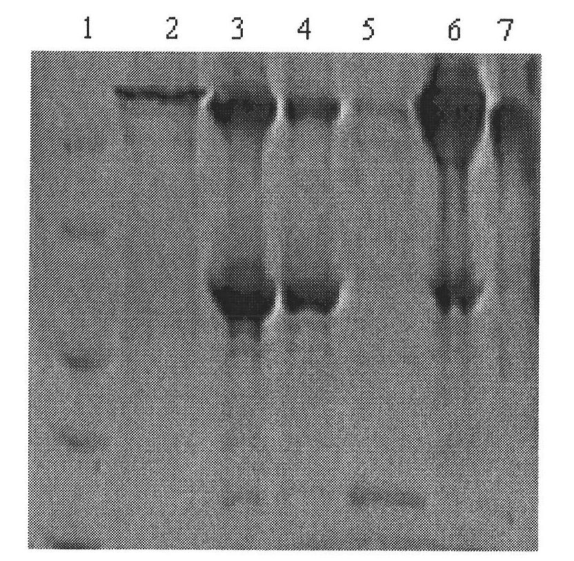 Method for preparing novel affinity medium and application thereof