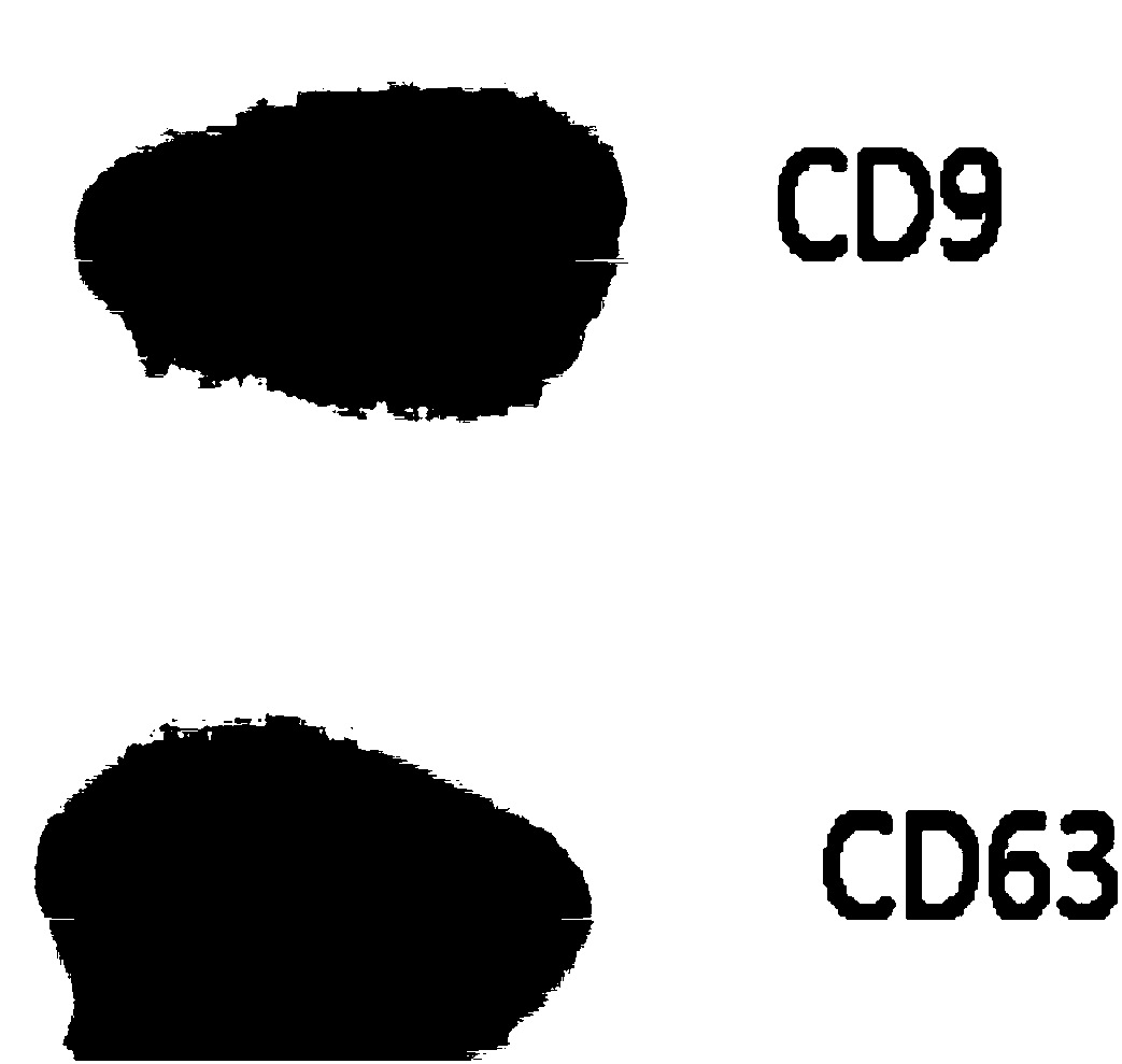 Human pluripotent stem cell exosome loaded with resveratrol, and preparation method and application thereof