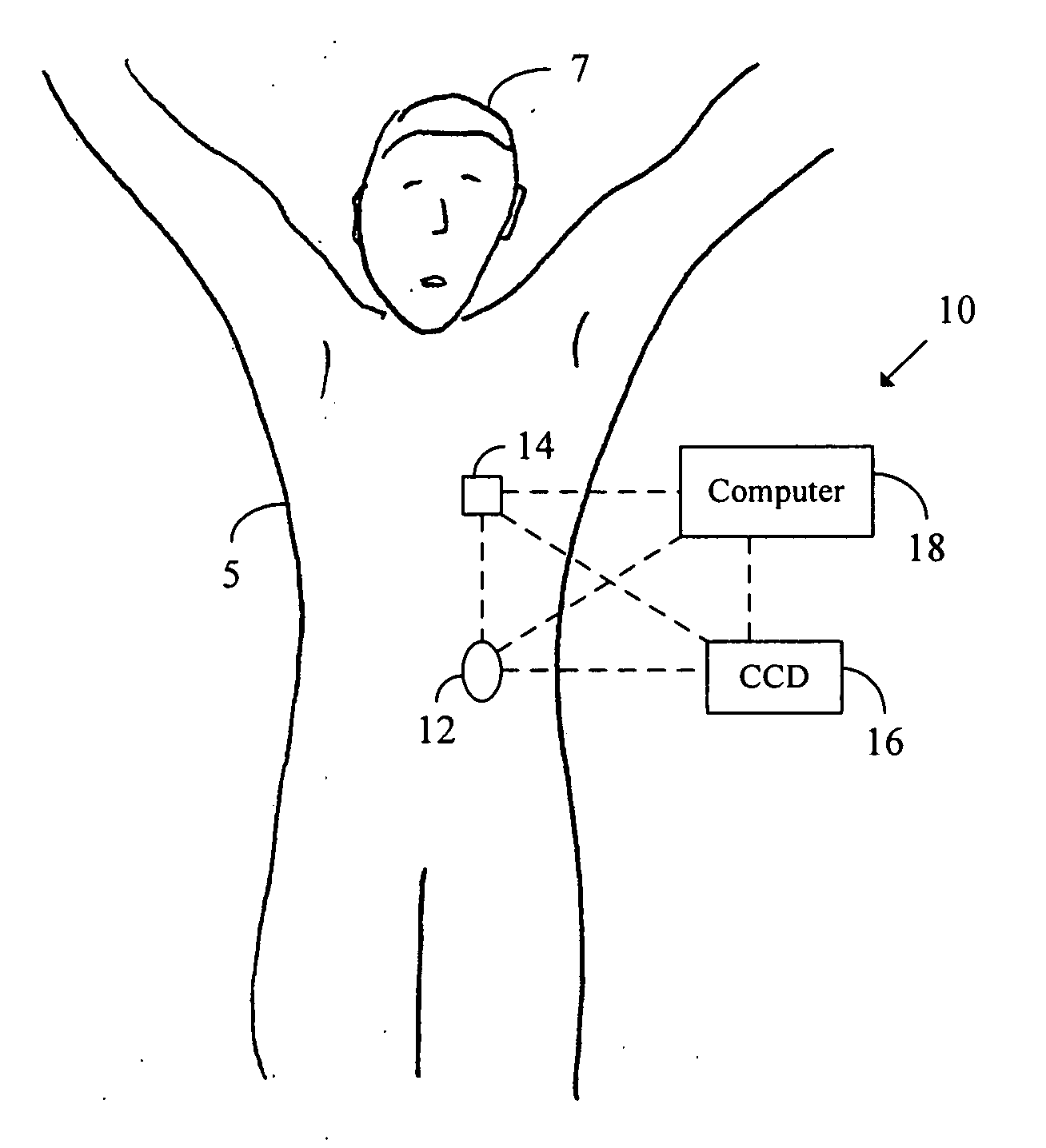 Systems and methods allowing for reservoir filling and infusion medium delivery