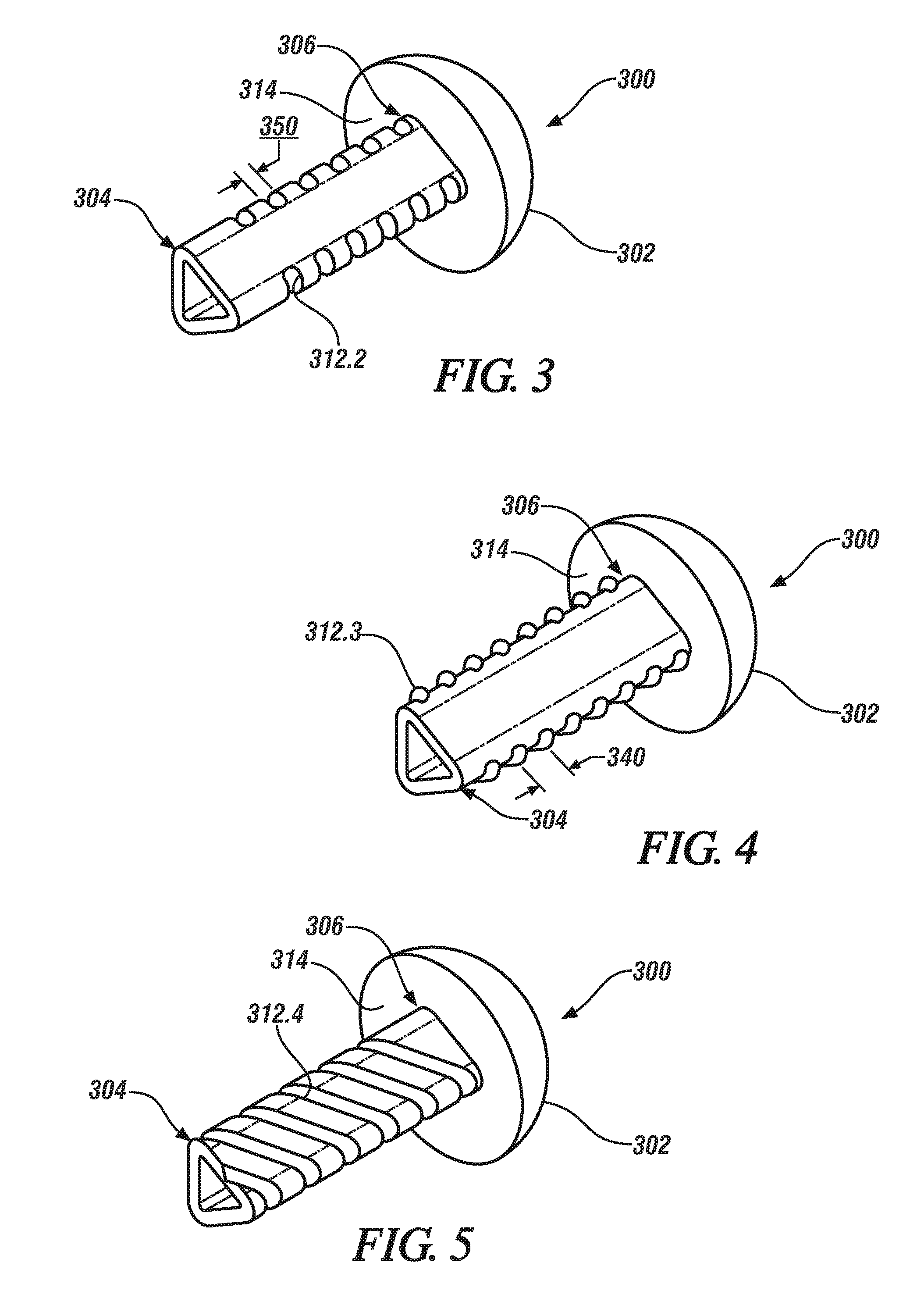 Elastically deformable alignment fastener and system