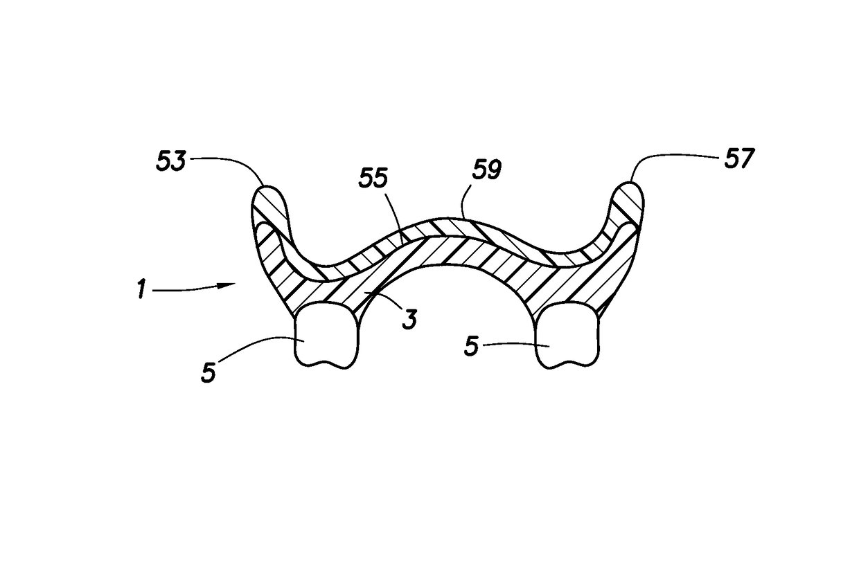 One visit denture