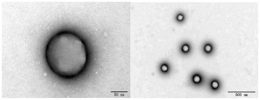 Rapamycin nanoparticle for use in porous percutaneous transluminal angioplasty