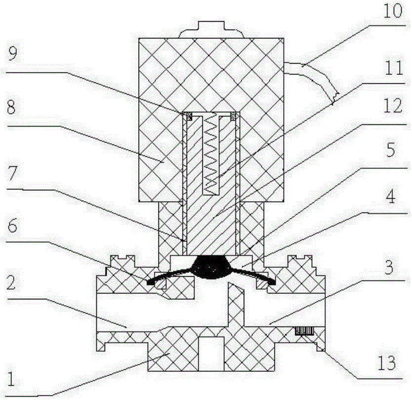 Electromagnetic valve for hemodialysis