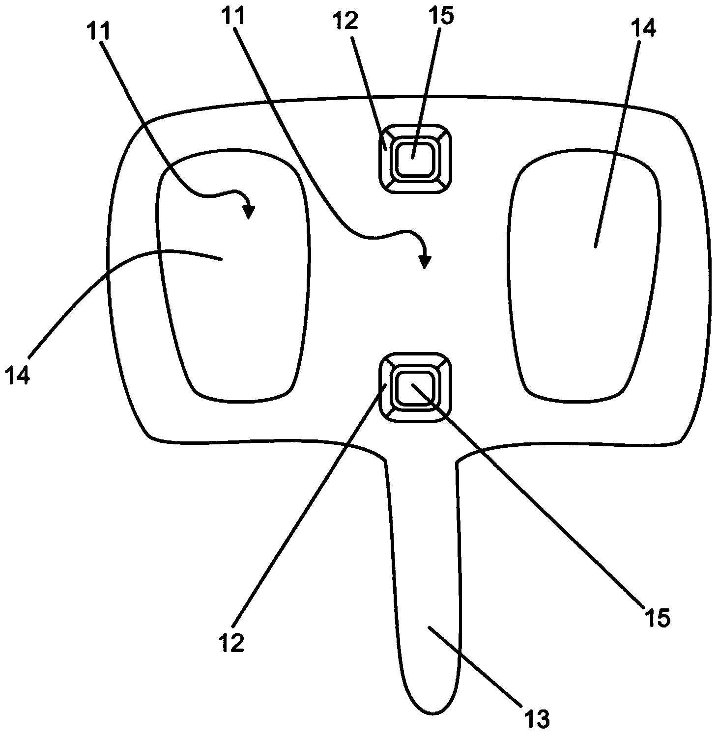 Device and method for the in-situ production of articulating spacers