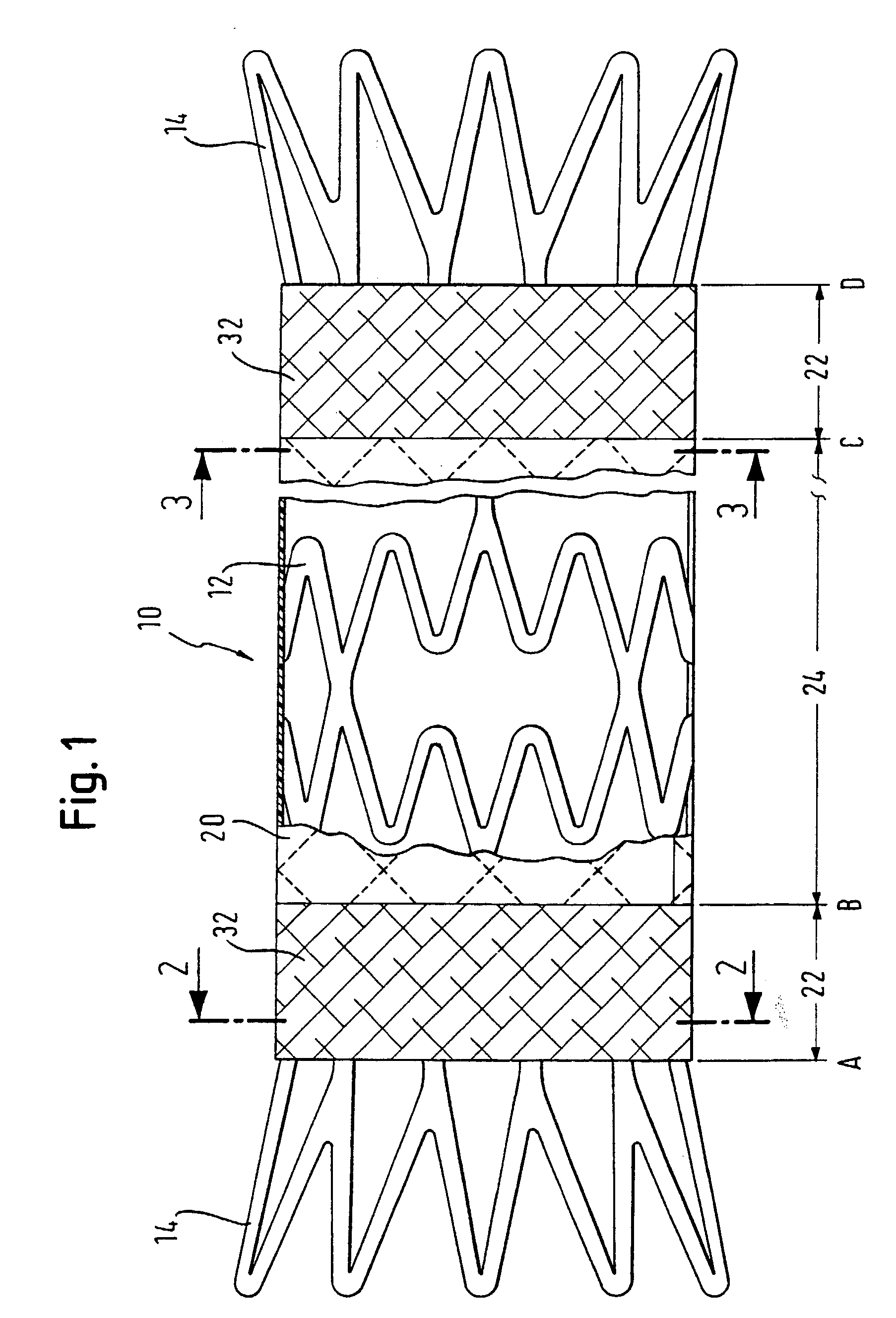 Stent matrix