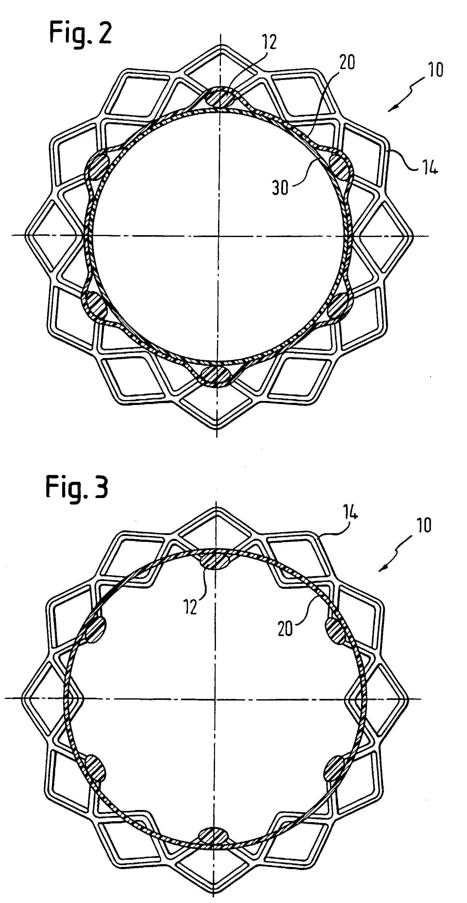 Stent matrix