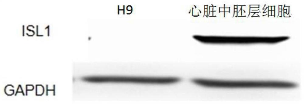 Method for preparing heart valve endothelial cells by inducing pluripotent stem cell differentiation, and application of heart valve endothelial cells