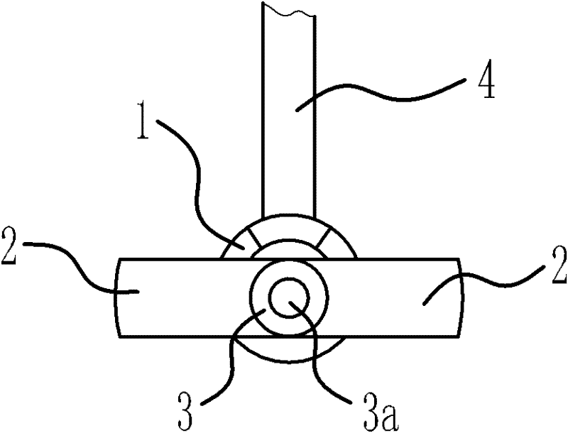 artificial nasolacrimal duct