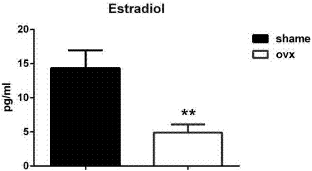 Traditional Chinese medicine compound preparation for treating osteoporotic fractures and preparation method and application thereof