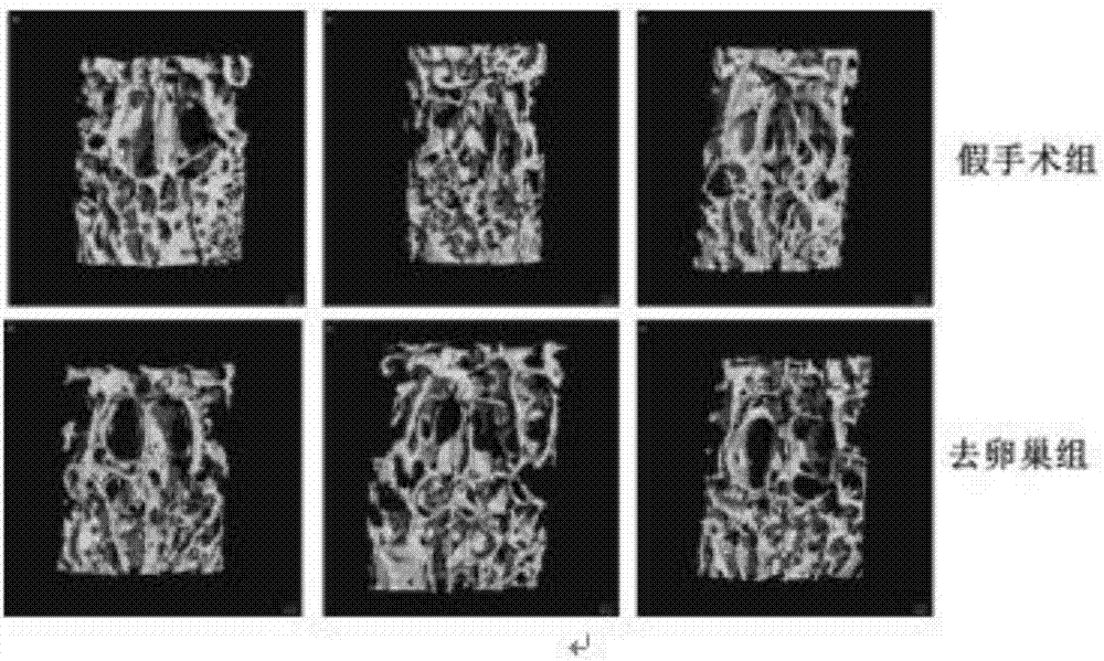 Traditional Chinese medicine compound preparation for treating osteoporotic fractures and preparation method and application thereof