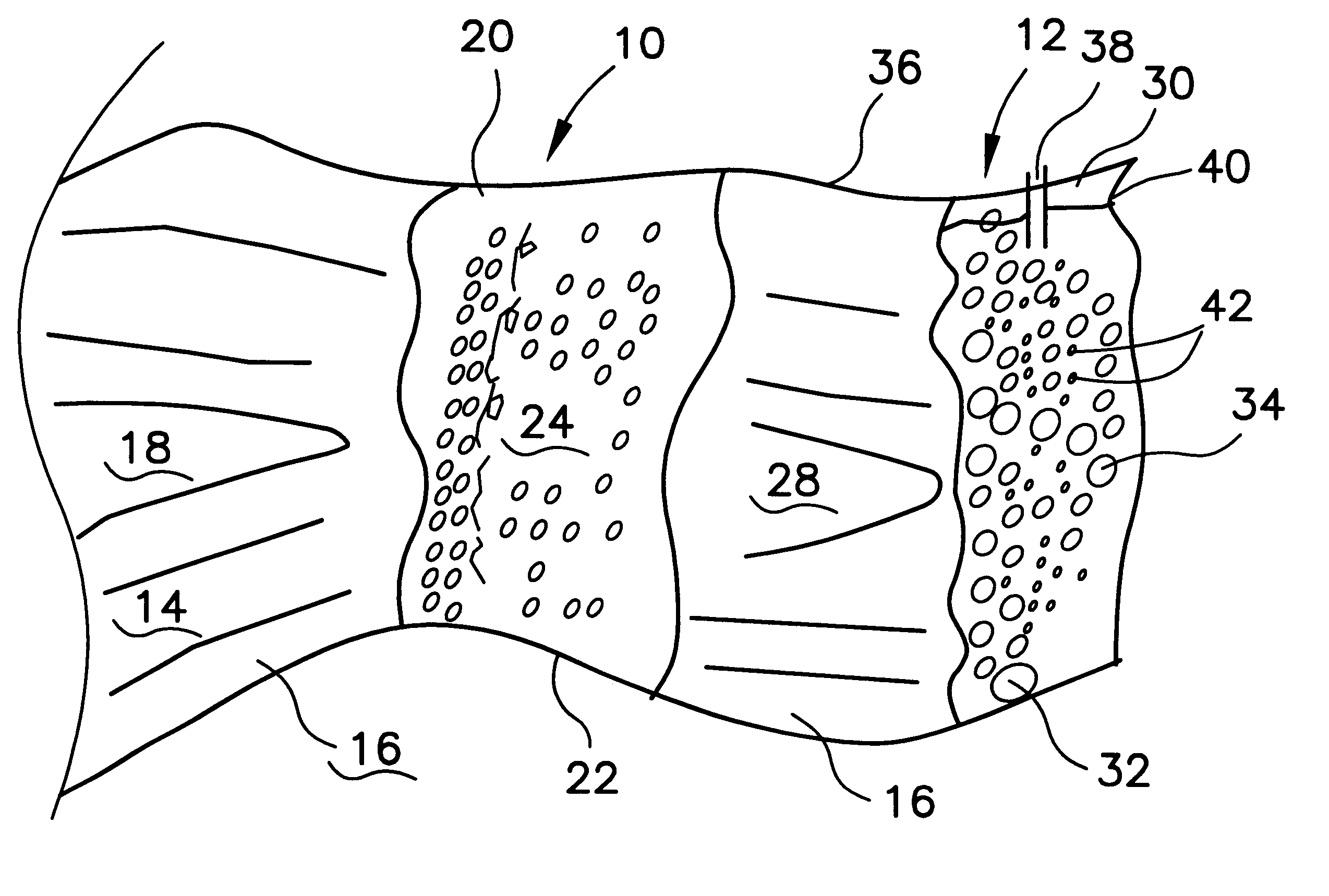 In-situ method to remove iron and other metals from solution in groundwater down gradient from permeable reactive barrier