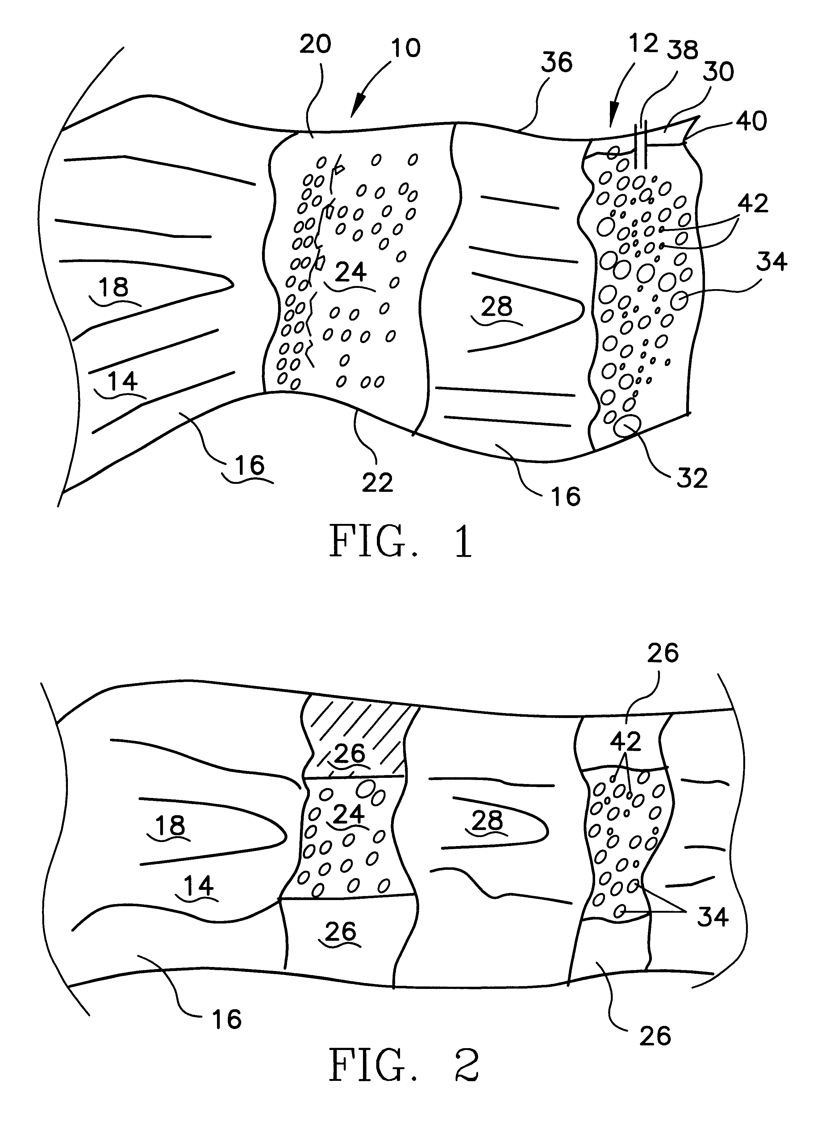 In-situ method to remove iron and other metals from solution in groundwater down gradient from permeable reactive barrier