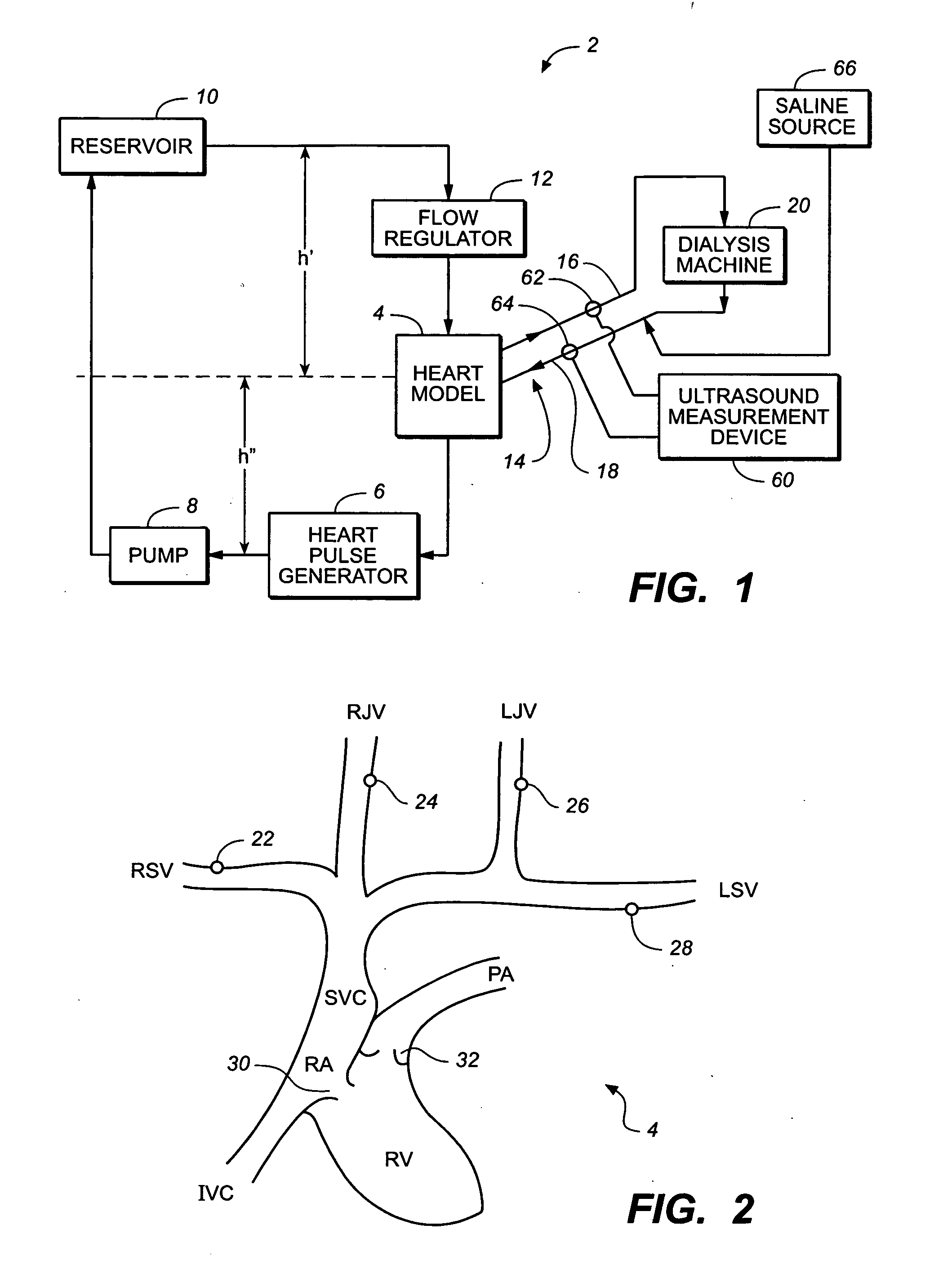 Method for measuring recirculation in catheters