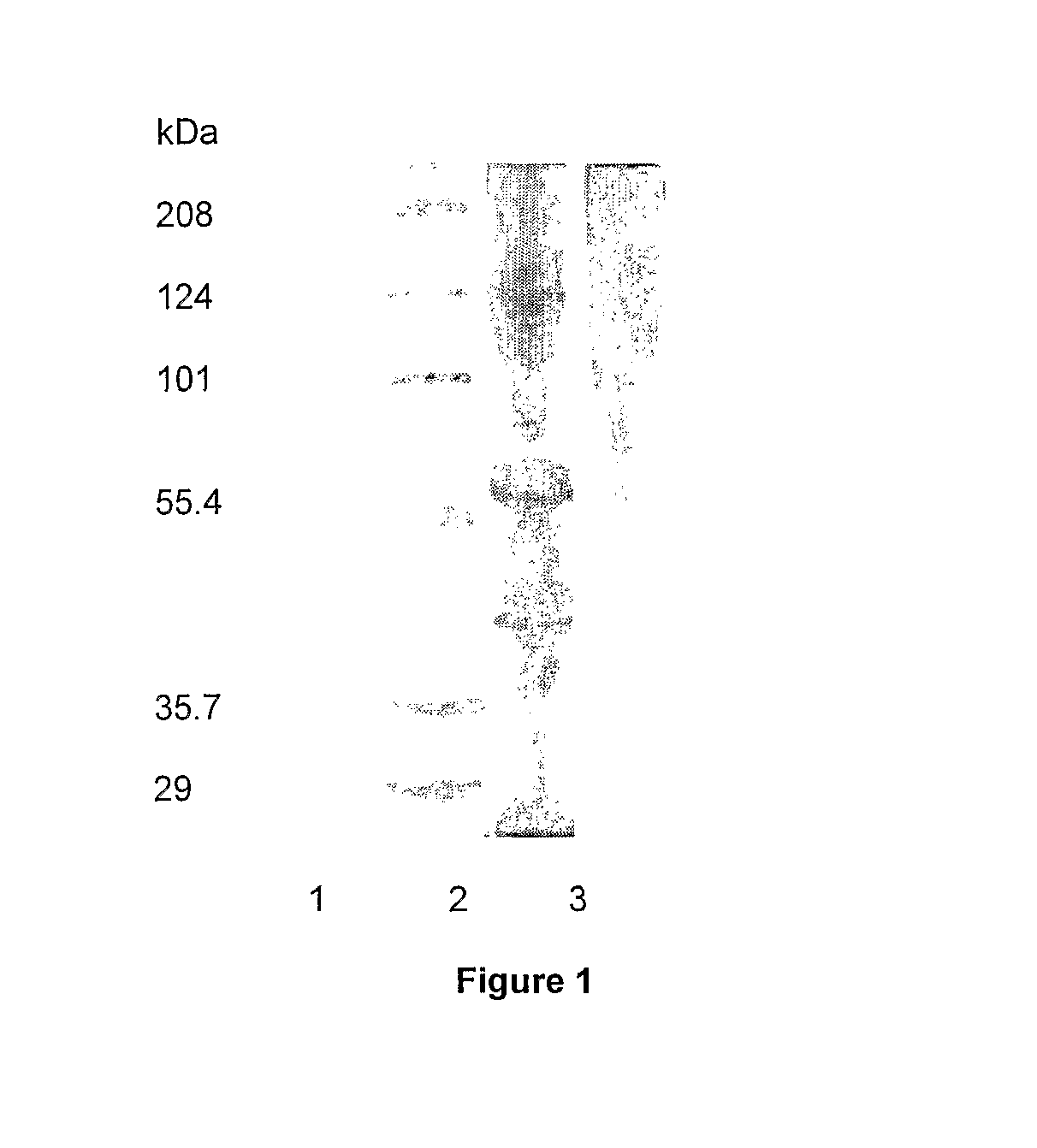 Extraction Of Gelatin