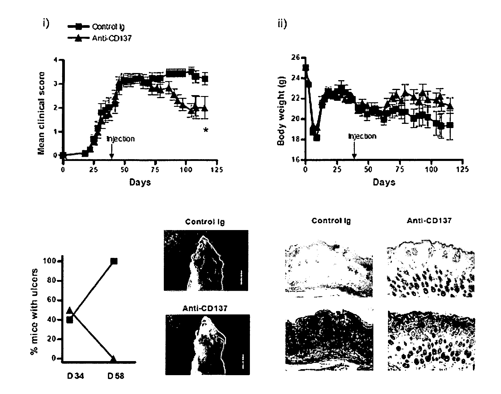 Pharmaceutical Composition for Preventing or Treating Chronic Graft-Versus-Disease Comprising Anti-CD137 Monoclonal Antibody