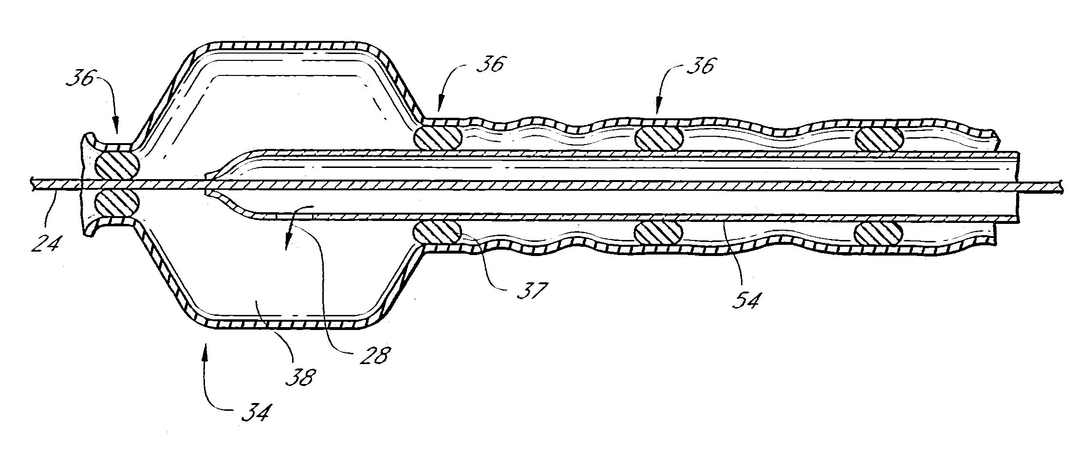 Tissue Augmentation Device