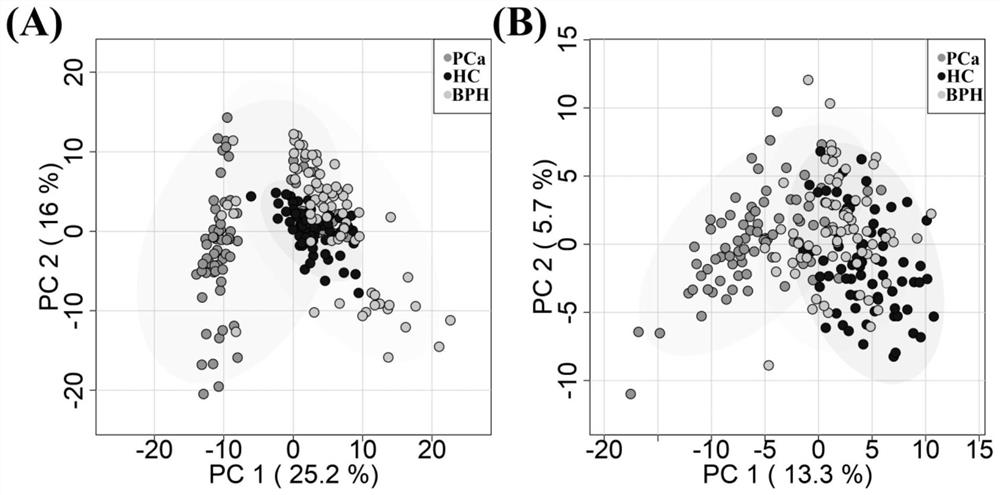 Method for screening prostate cancer PSA diagnosis gray region serum marker