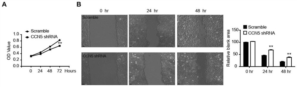 Stromal cell protein CCN5 composition and application thereof