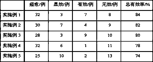 Traditional Chinese medicine preparation for treating oral ulcers and preparation method thereof