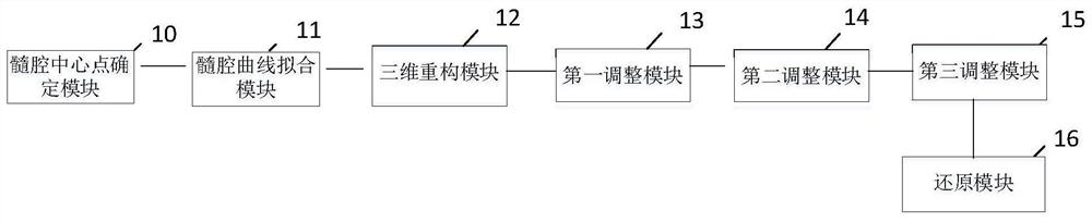 Knee joint thighbone posterior condyle point identification method and system based on motion simulation algorithm