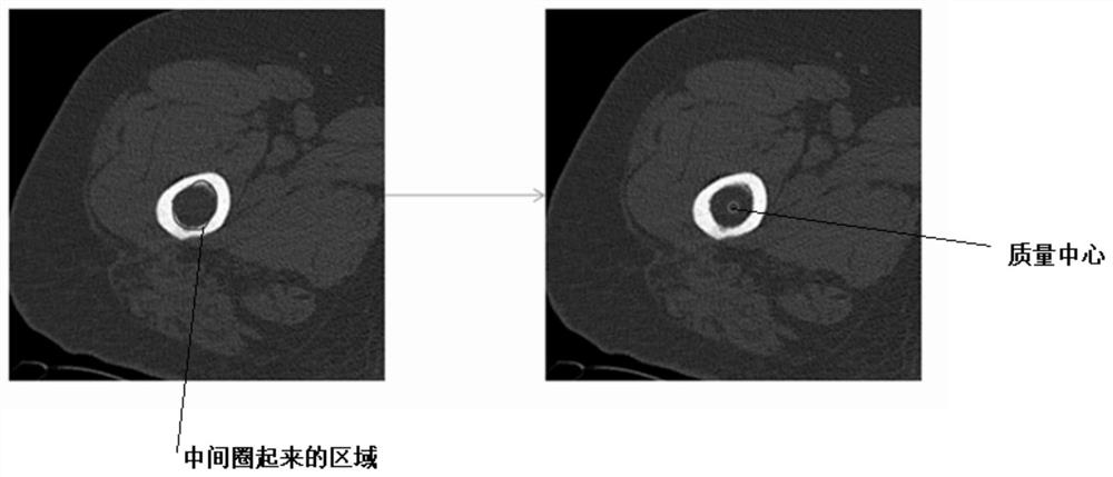 Knee joint thighbone posterior condyle point identification method and system based on motion simulation algorithm