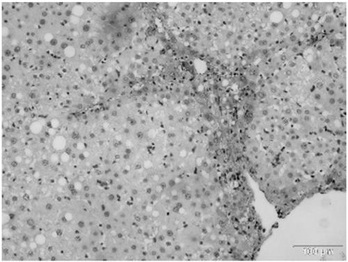 Recombinant adenovirus, preparation method and application