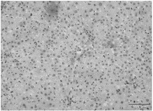 Recombinant adenovirus, preparation method and application