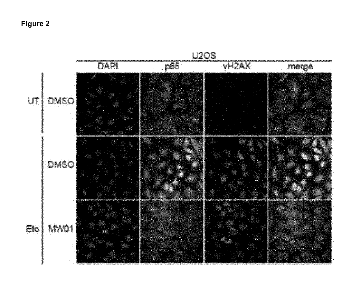 Selective inhibitors of gentotoxic steress-induced ikk/nf-kb pathways