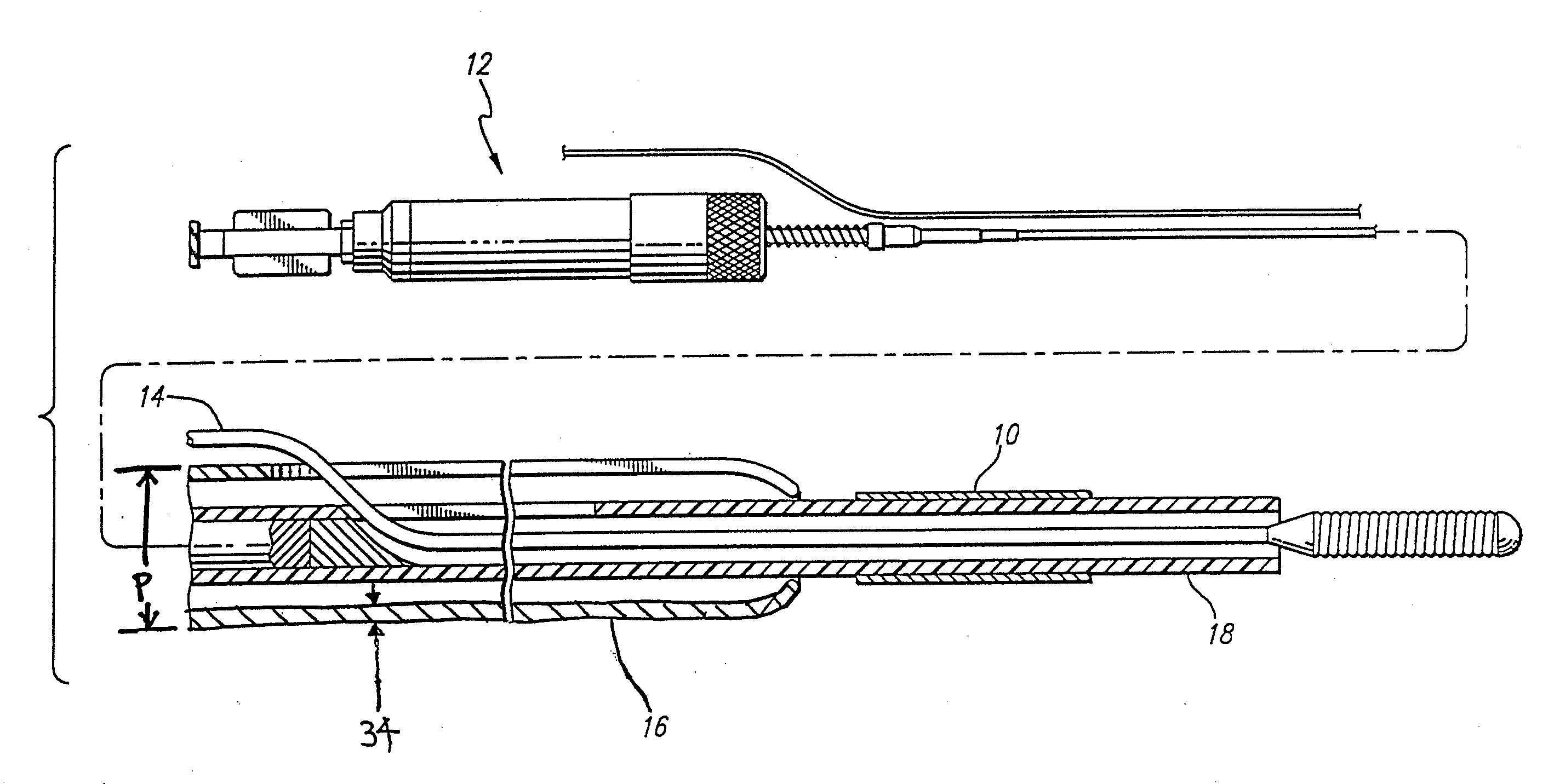 Nitinol alloy design and composition for vascular stents